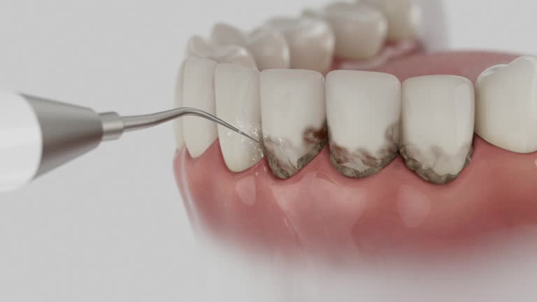 Trusted Emergency Dentist service in Severn, MD - Dentist Open Now